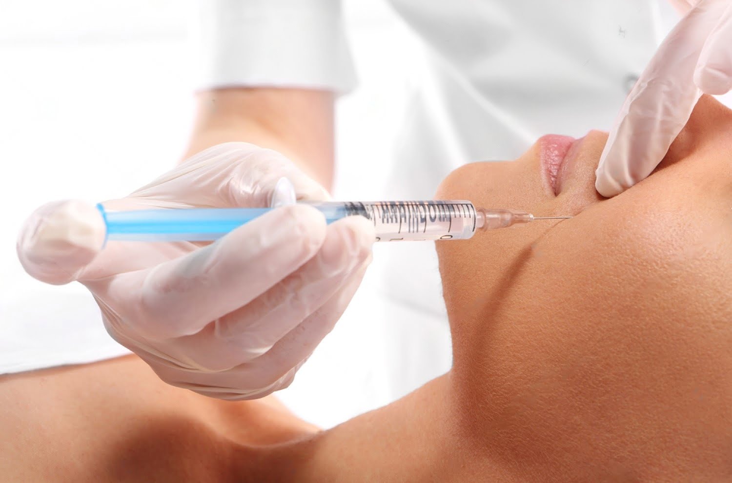 Antes e depois do Preenchimento de Bigode Chinês